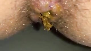 Shit falls out of a hairy ass and onto a phone