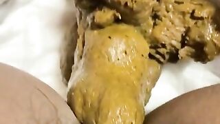 Shitting on the diaper