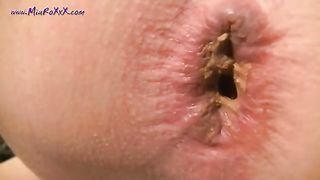 nice round ass taking a shit filmed up close