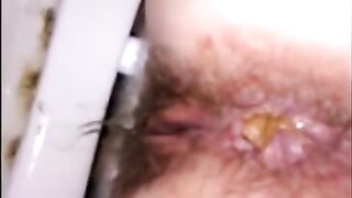 Nasty granny lady shitting hard shit