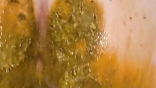 Extreme Jeans Accident