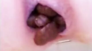 Shitting Redhead Ginger slut