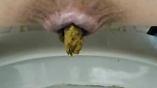 Round dark asshole and sticky shit