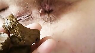 Shitting on his hand