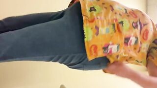 Rectal prolapse with shit