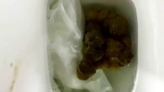 Stubborn and Stuck Poop closeup