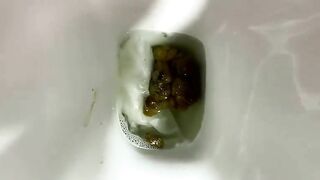 Stubborn and Stuck Poop closeup