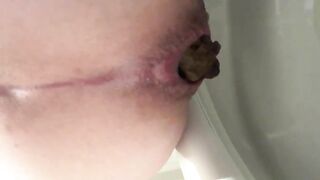 Dark turd stuck closeup