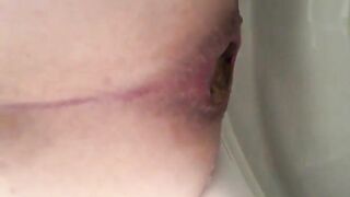 Dark turd stuck closeup