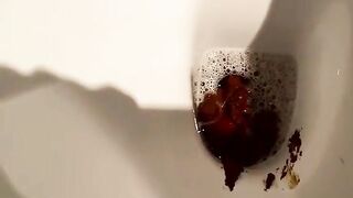 White ass takes out giant turds