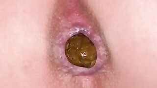 Sweet pooping asshole closeup