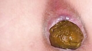 Sweet pooping asshole closeup