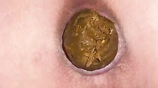 Sweet pooping asshole closeup