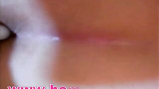 suppository for big dump