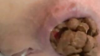 Thick hard poop from poor asshole