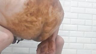 Anal