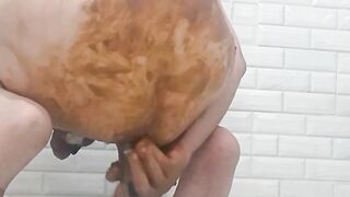Anal