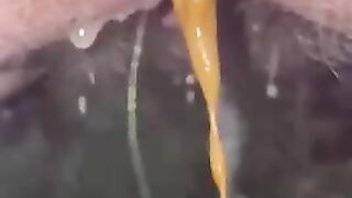 Demented dumb fuck