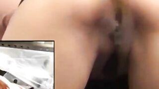 Diarrhea