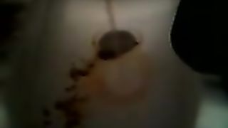 Diarheea from my girlfriend