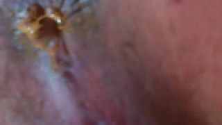 Yellow shit in close up