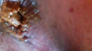 Yellow shit in close up