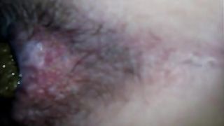 A turd so big that made her bleed