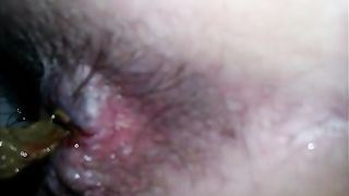 A turd so big that made her bleed