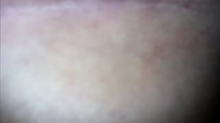 A turd so big that made her bleed