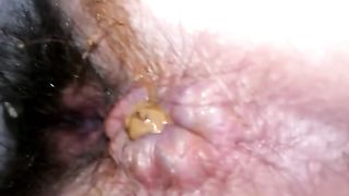 Turd stuck in her asshole