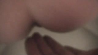 Poop on my husbands hand