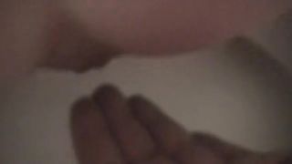 Poop on my husbands hand