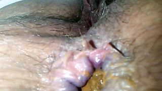 diarrhea filmed up close