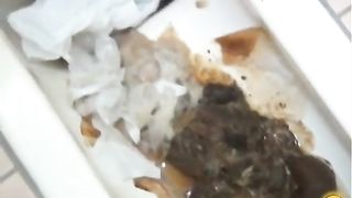 Poop over a shitty toilet