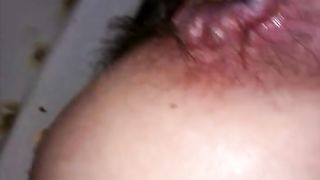 Poop stuck in hairy asshole