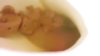 Two best friends pooping