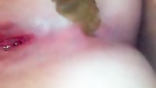 Girl on period pooping