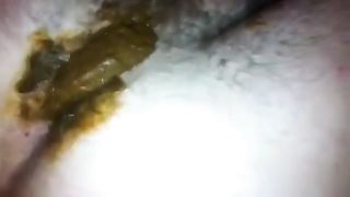 Trying to stop the urge to pee