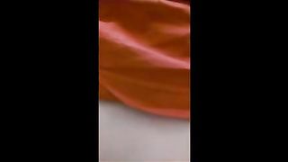 Anal prolapse - nasty