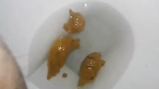 Yellow crap from hairy ass