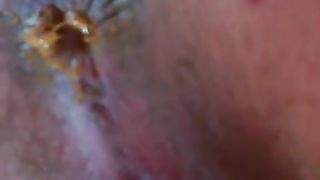 Pussy and ass in close up