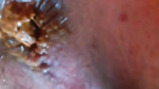 Pussy and ass in close up